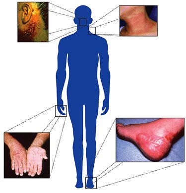 skin1 - مضرات کود شیمیایی محاسن ورمی کمپوست